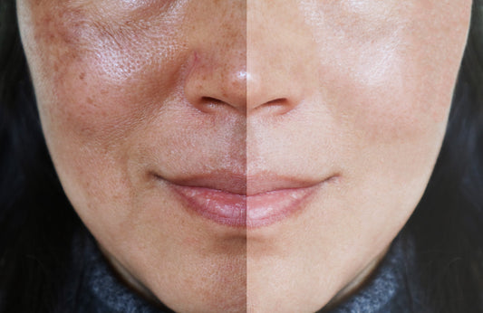 a womans face shown in two halls one side showing her skin when using high street skincare, the other side showing the skin improvement when using medical-grade skincare