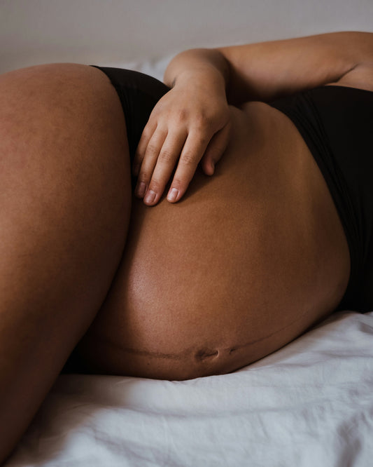 image of a pregnant lady showing suitable skin care during pregnancy