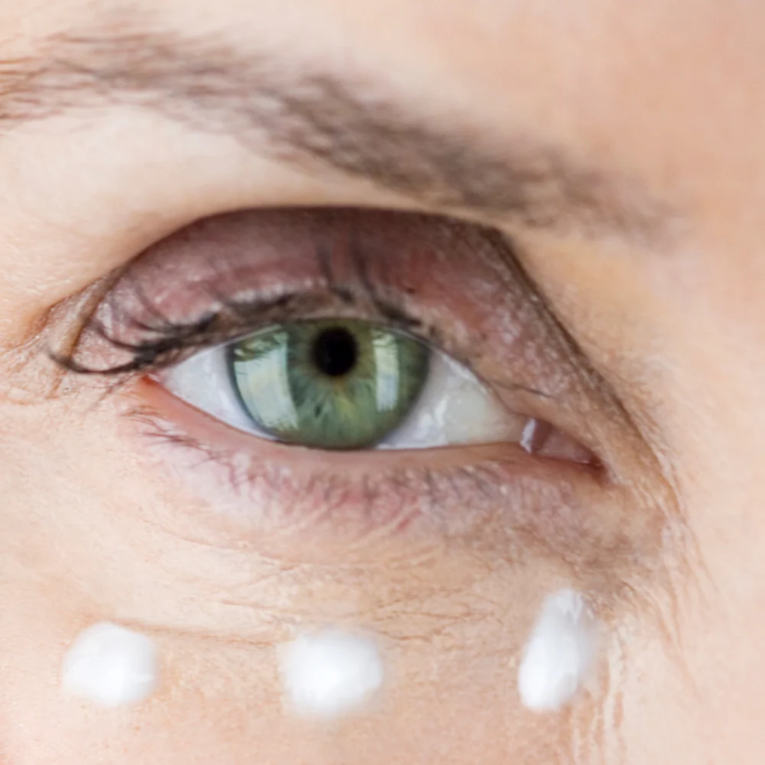 Clinical Skin Ultra-Rich Eye Cream for hydrating, nourishing, and reducing fine lines, puffiness, and dark circles around the eyes