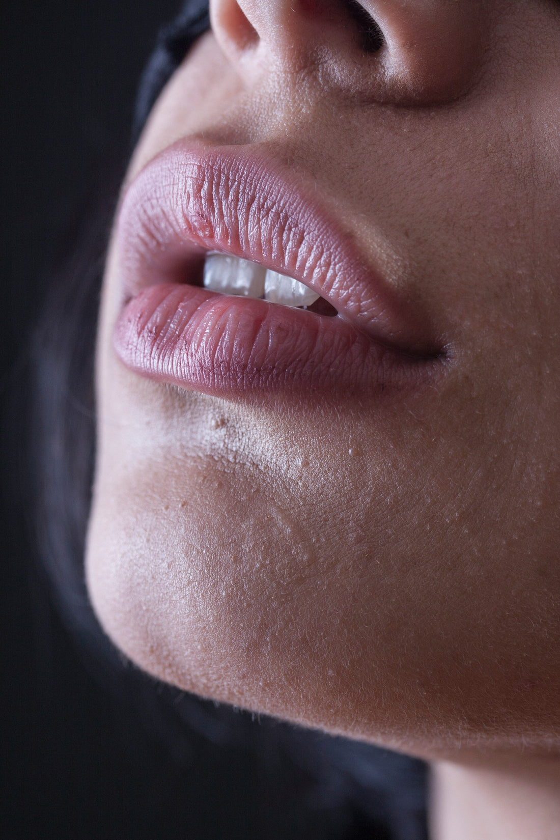 Revision Skincare YouthFull Lip Replenisher treatment for chapped lips