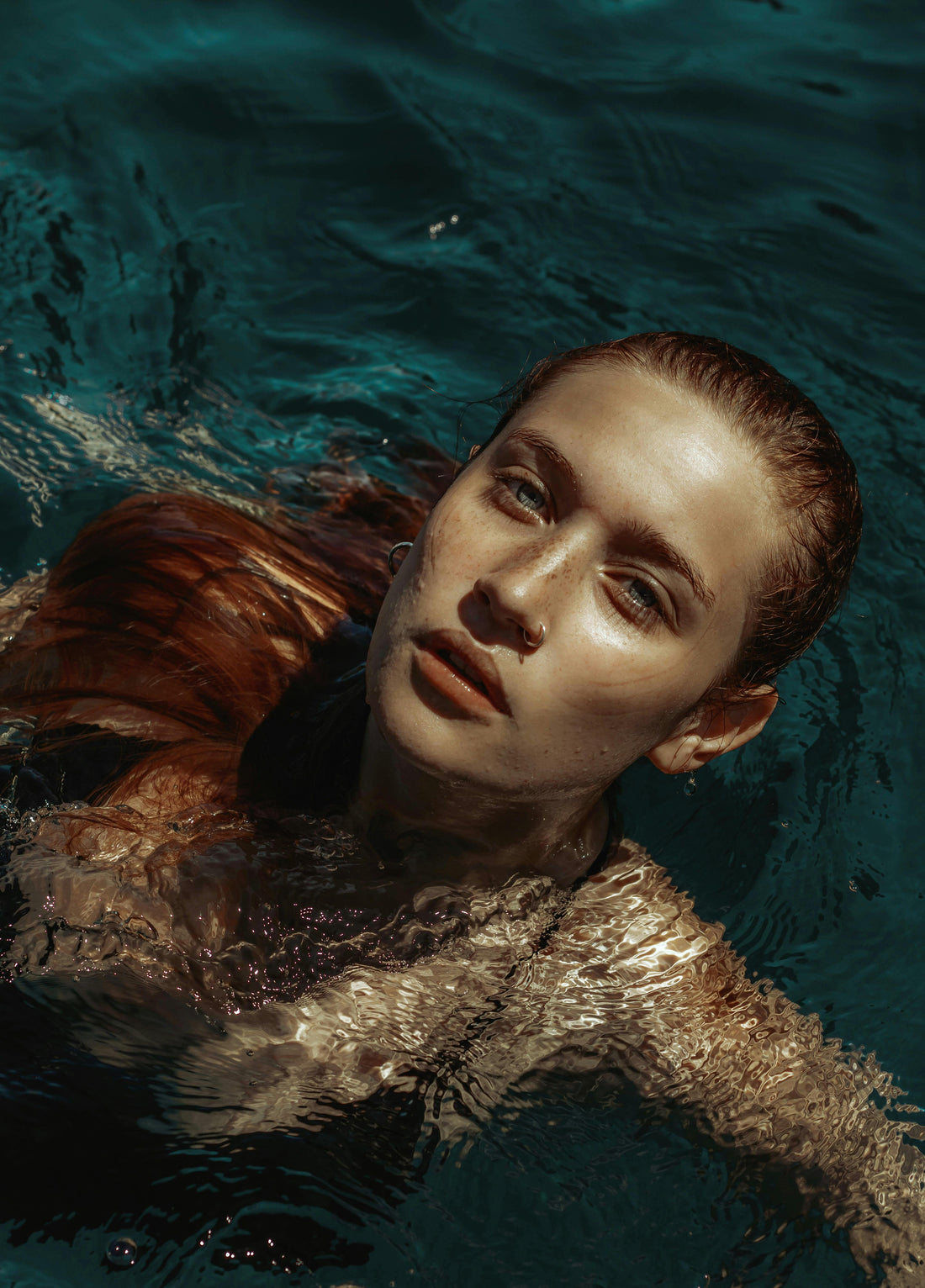 Summer Sun, Hyperpigmentation And How to Protect Your Skin: The Skincare Plan That Works